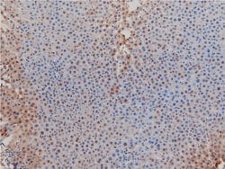 Invitrogen Phospho-LIMK1 (Thr508) Polyclonal Antibody 100 &mu;L | Buy Online | Invitrogen&trade; | Fisher Scientific