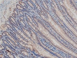 Invitrogen Phospho-LIMK1 (Thr508) Polyclonal Antibody 100 &mu;L | Buy Online | Invitrogen&trade; | Fisher Scientific