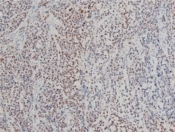 Invitrogen Phospho-LIMK1 (Thr508) Polyclonal Antibody 100 &mu;L | Buy Online | Invitrogen&trade; | Fisher Scientific