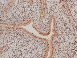 Invitrogen Phospho-LIMK1 (Thr508) Polyclonal Antibody 100 &mu;L | Buy Online | Invitrogen&trade; | Fisher Scientific