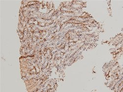 Invitrogen Phospho-LIMK1 (Thr508) Polyclonal Antibody 100 &mu;L | Buy Online | Invitrogen&trade; | Fisher Scientific
