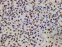 Invitrogen Phospho-LIMK1 (Thr508) Polyclonal Antibody 100 &mu;L | Buy Online | Invitrogen&trade; | Fisher Scientific