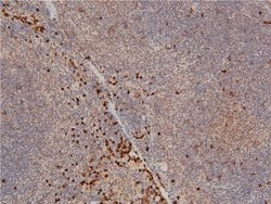 Invitrogen Phospho-LIMK1 (Thr508) Polyclonal Antibody 100 &mu;L | Buy Online | Invitrogen&trade; | Fisher Scientific