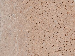 Invitrogen Phospho-LIMK1 (Thr508) Polyclonal Antibody 100 &mu;L | Buy Online | Invitrogen&trade; | Fisher Scientific
