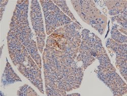 Invitrogen Phospho-LIMK1 (Thr508) Polyclonal Antibody 100 &mu;L | Buy Online | Invitrogen&trade; | Fisher Scientific