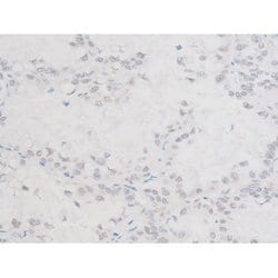Invitrogen Phospho-LIMK1 (Thr508) Polyclonal Antibody 100 &mu;L | Buy Online | Invitrogen&trade; | Fisher Scientific