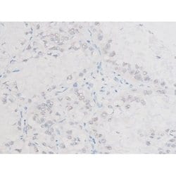 Invitrogen Phospho-LIMK1 (Thr508) Polyclonal Antibody 100 &mu;L | Buy Online | Invitrogen&trade; | Fisher Scientific