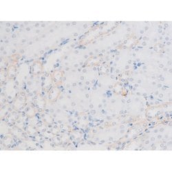 Invitrogen Phospho-LIMK1 (Thr508) Polyclonal Antibody 100 &mu;L | Buy Online | Invitrogen&trade; | Fisher Scientific