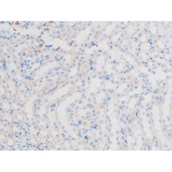 Invitrogen Phospho-LIMK1 (Thr508) Polyclonal Antibody 100 &mu;L | Buy Online | Invitrogen&trade; | Fisher Scientific