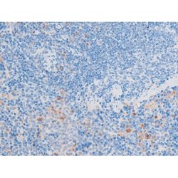Invitrogen Phospho-LIMK1 (Thr508) Polyclonal Antibody 100 &mu;L | Buy Online | Invitrogen&trade; | Fisher Scientific