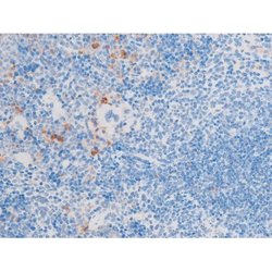 Invitrogen Phospho-LIMK1 (Thr508) Polyclonal Antibody 100 &mu;L | Buy Online | Invitrogen&trade; | Fisher Scientific