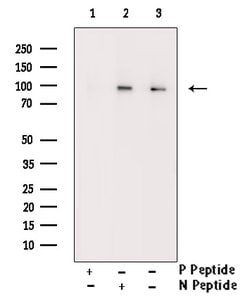 Phospho-KV2.1 (KCNB1) (Ser805) Polyclonal Antibody, Invitrogen 100 &mu;L | Buy Online | Invitrogen | Fisher Scientific
