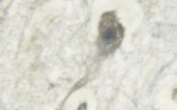 Phospho-PKC mu (Tyr463) Polyclonal Antibody, Invitrogen 100 &mu;L; Unconjugated:Antibodies,