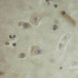 Invitrogen Phospho-FRS2 (Tyr436) Polyclonal Antibody 100 μL; Unconjugated:Antibodies,