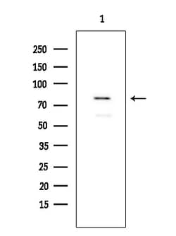 Invitrogen FOXP1 Polyclonal Antibody 100 &mu;L; Unconjugated:Antibodies,