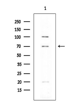 Invitrogen FOXP1 Polyclonal Antibody 100 &mu;L; Unconjugated:Antibodies,