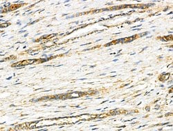 Invitrogen NDUFA4 Polyclonal Antibody 100 &mu;L; Unconjugated:Antibodies,