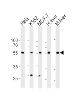 Invitrogen BMPR1A Polyclonal Antibody 400 &mu;L; Unconjugated:Antibodies,