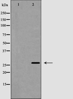 Invitrogen APRIL Polyclonal Antibody 100 &mu;L; Unconjugated:Antibodies,