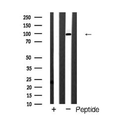 Invitrogen mGluR4 Polyclonal Antibody 100 &mu;L; Unconjugated:Antibodies,