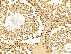 Invitrogen HSP70 Polyclonal Antibody 100 &mu;L; Unconjugated:Antibodies,
