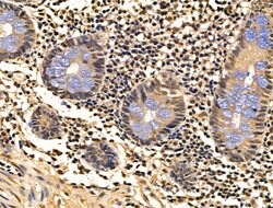 Invitrogen HSP70 Polyclonal Antibody 100 &mu;L; Unconjugated:Antibodies,