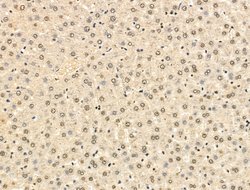 Invitrogen HSP70 Polyclonal Antibody 100 &mu;L; Unconjugated:Antibodies,