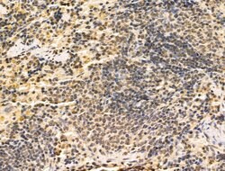 Invitrogen HSP70 Polyclonal Antibody 100 &mu;L; Unconjugated:Antibodies,