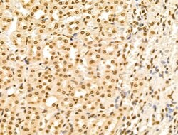 Invitrogen HSP70 Polyclonal Antibody 100 &mu;L; Unconjugated:Antibodies,