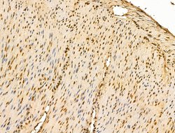 Invitrogen HSP70 Polyclonal Antibody 100 &mu;L; Unconjugated:Antibodies,
