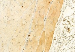 Invitrogen Phospho-ASK1 (Thr838) Polyclonal Antibody 100 &mu;L; Unconjugated:Antibodies,