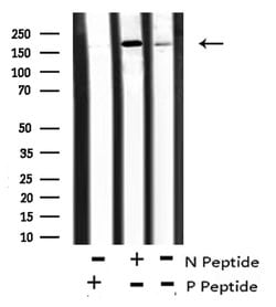 Invitrogen Phospho-ASK1 (Thr838) Polyclonal Antibody 100 &mu;L; Unconjugated:Antibodies,