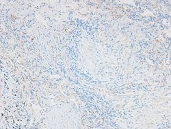 Invitrogen Phospho-Caveolin 2 (Ser23) Polyclonal Antibody 100 &mu;L; Unconjugated:Antibodies,