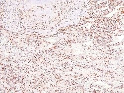 Invitrogen Phospho-Caveolin 2 (Ser36) Polyclonal Antibody 100 &mu;L | Buy Online | Invitrogen&trade; | Fisher Scientific