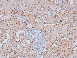 Invitrogen Phospho-Caveolin 2 (Ser36) Polyclonal Antibody 100 &mu;L | Buy Online | Invitrogen&trade; | Fisher Scientific