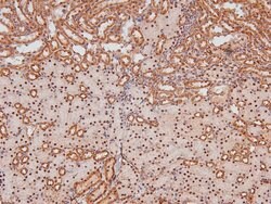 Invitrogen Phospho-Caveolin 2 (Ser36) Polyclonal Antibody 100 &mu;L | Buy Online | Invitrogen&trade; | Fisher Scientific