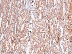 Invitrogen Phospho-FOXO4 (Thr455) Polyclonal Antibody 100 &mu;L | Buy Online | Invitrogen&trade; | Fisher Scientific