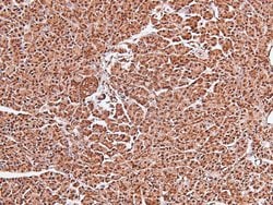 Invitrogen Phospho-FOXO4 (Thr455) Polyclonal Antibody 100 &mu;L | Buy Online | Invitrogen&trade; | Fisher Scientific