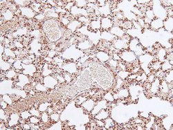 Invitrogen Phospho-FOXO4 (Thr455) Polyclonal Antibody 100 &mu;L | Buy Online | Invitrogen&trade; | Fisher Scientific