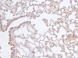 Invitrogen Phospho-FOXO4 (Thr455) Polyclonal Antibody 100 &mu;L | Buy Online | Invitrogen&trade; | Fisher Scientific