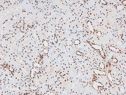 Phospho-JAK2/JAK3 (Tyr966, Tyr939) Polyclonal Antibody, Invitrogen 100