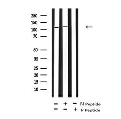 Phospho-JAK2/JAK3 (Tyr966, Tyr939) Polyclonal Antibody, Invitrogen 100