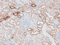 Invitrogen Phospho-p70 S6 Kinase (Ser427) Polyclonal Antibody 100 &mu;L;