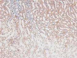 Invitrogen Phospho-p70 S6 Kinase (Ser427) Polyclonal Antibody 100 &mu;L;