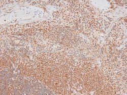 Invitrogen Phospho-p70 S6 Kinase (Ser427) Polyclonal Antibody 100 &mu;L;
