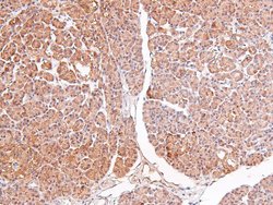 Phospho-RSK3 (Ser360) Polyclonal Antibody, Invitrogen 100 &mu;L; Unconjugated:Antibodies,