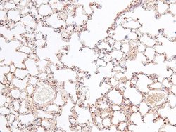 Phospho-RSK3 (Ser360) Polyclonal Antibody, Invitrogen 100 &mu;L; Unconjugated:Antibodies,