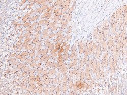 Phospho-RSK3 (Ser360) Polyclonal Antibody, Invitrogen 100 &mu;L; Unconjugated:Antibodies,