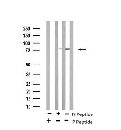 Phospho-RSK3 (Ser360) Polyclonal Antibody, Invitrogen 100 &mu;L; Unconjugated:Antibodies,