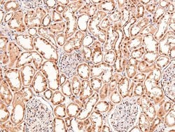 Invitrogen Phospho-BRCA1 (Ser1497) Polyclonal Antibody 100 μL; Unconjugated:Antibodies,